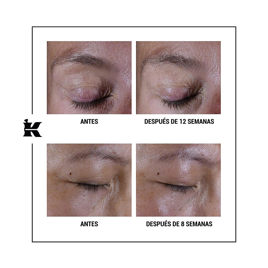 Super Multi-Corrective Eye Zone Treatment