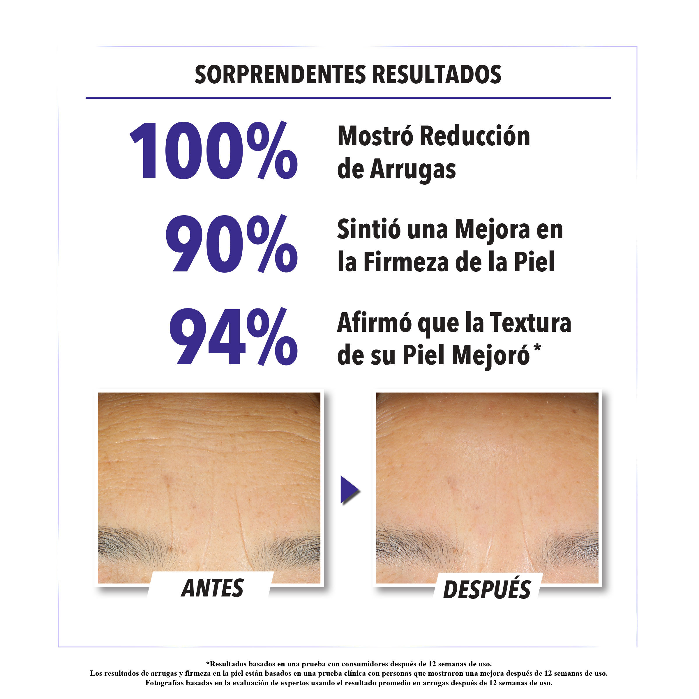 Retinol Skin-Renewing Daily Micro-Dose Serum