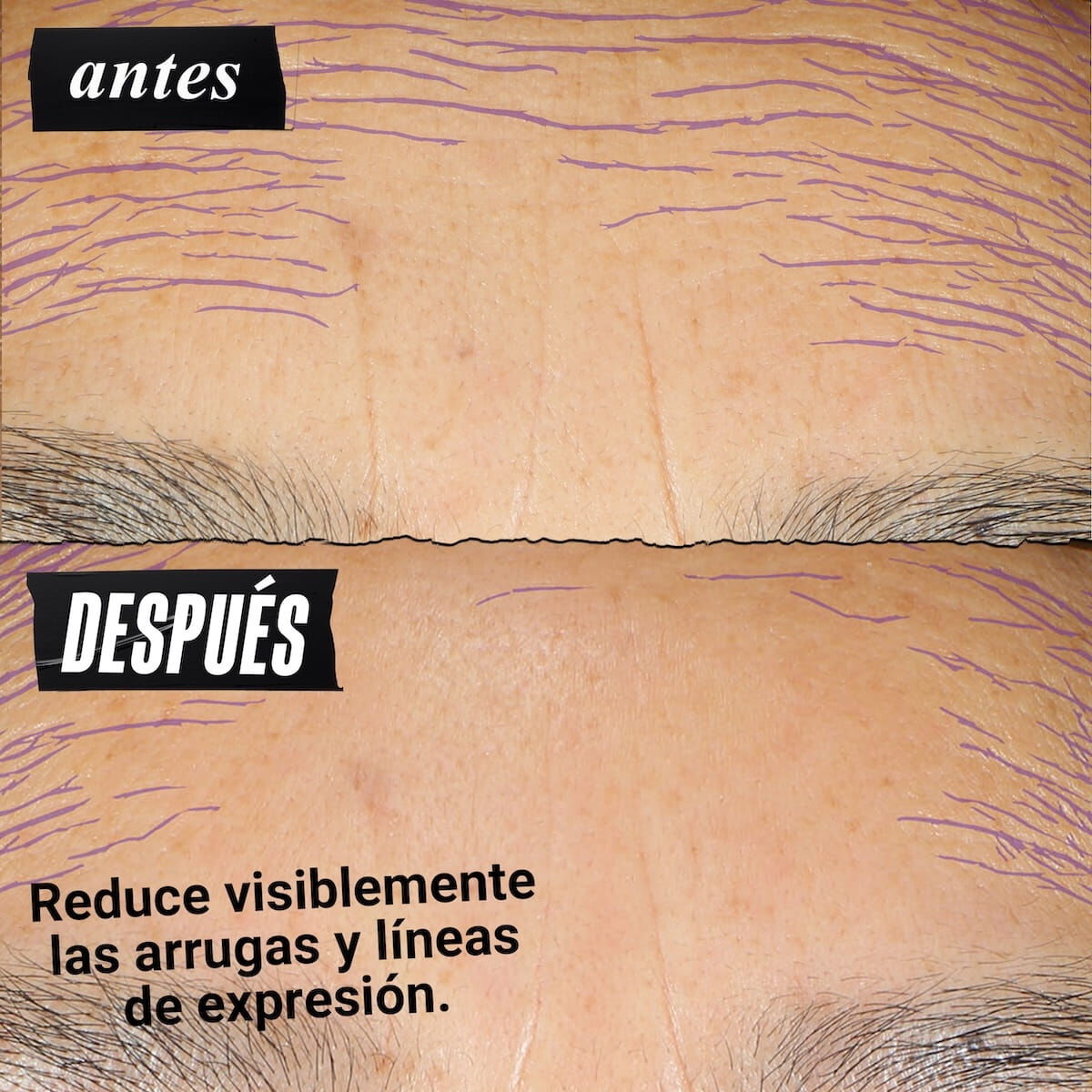 Kiehl's Retinol: Skin-Renewing Daily Micro-Dose Serum