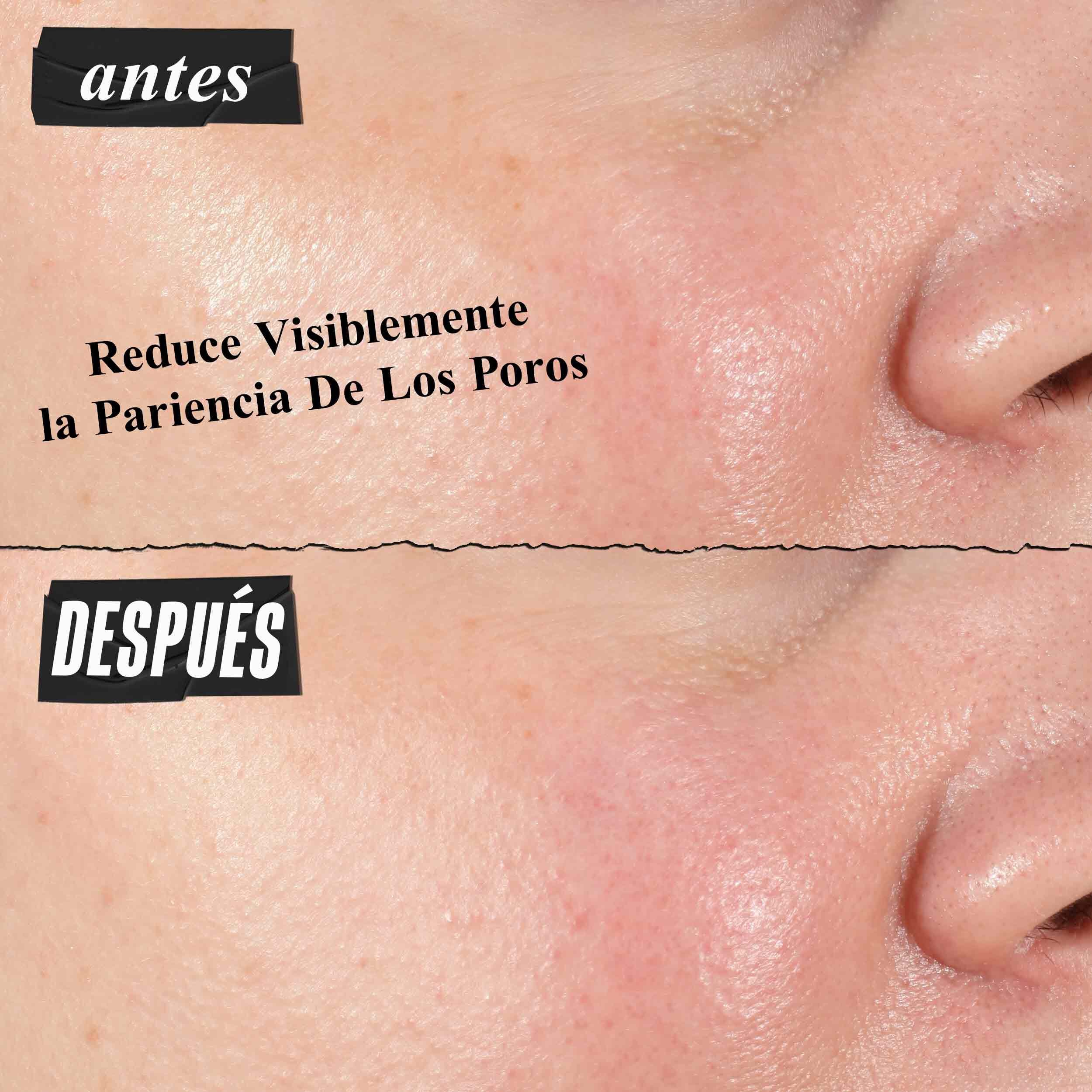 Hydro-Plumping Serum Concentrate