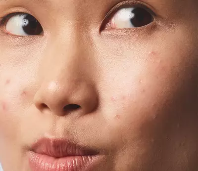 Rostro con tono de piel uniforme y aspecto luminoso