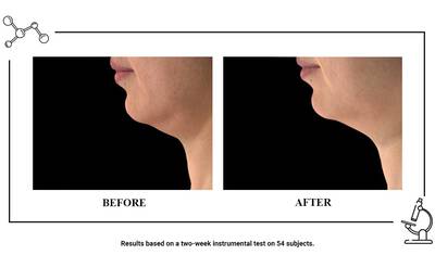 ANTES Y DESPUES Retinol Serum