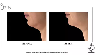 ANTES Y DESPUES Retinol Serum