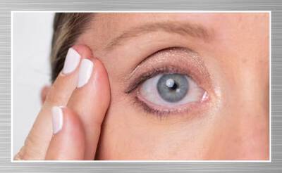 REAFIRMA LOS EXTREMOS DEL OJO