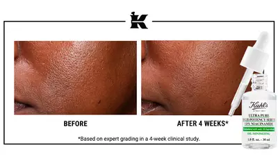 Antes y despues Retinol Serum