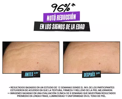 Antes y Despues Glycolic Acid Serum