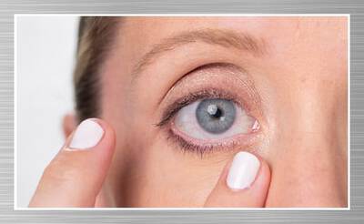 DESHINCHA EL CONTORNO DE LOS OJOS