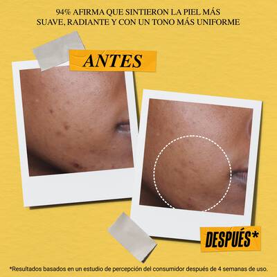 Antes y despues