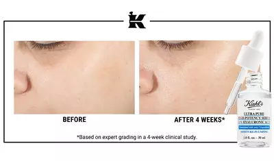 ANTES Y DESPUES Retinol Serum