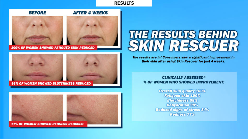 The Results Behind Skin Rescuer The Results Behind Skin Rescuer