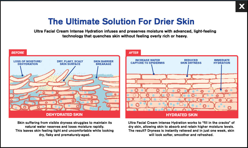 Ultra Facial Intense Results
