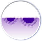 Discoloration